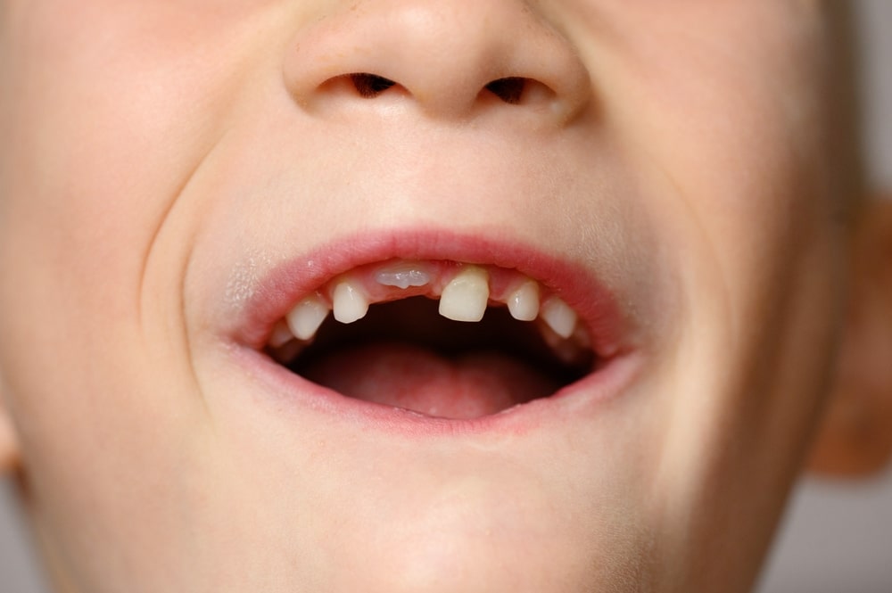 baby teeth to adult teeth transition